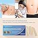 SIlicone Scar Sheets, 4pcs