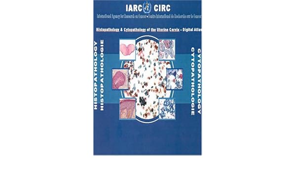 Histopathology And Cytopathology Of The Uterine Cervix - 