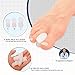 Dr. Frederick's Original Gel Toe Separators / Spacers - 6 ct - Temporary Bunion Corrector - Orthotic for Bunions & Overlapping Toe Pain - Ideal for Running, Yoga, and All-Day Foot Comfort - Large