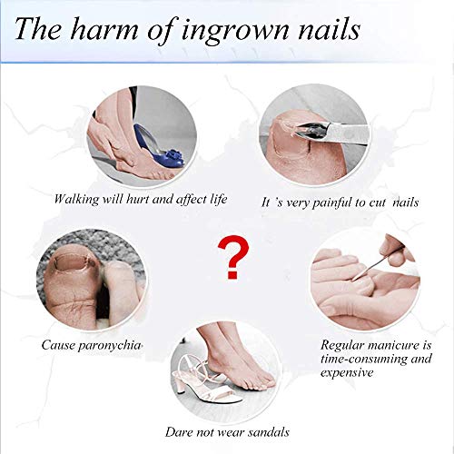 Ingrown Toenail Tool, Ingrown Toenail Correction PatchIngrown Toenail