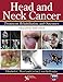 Head and Neck Cancer: Treatment, Rehabilitation, and Outcomes (DVD included)