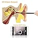 Ear Cleaning Endoscope, 3 in 1 Ear Wax Remover Tool 1.0Megapixels HD Waterproof Snake Camera with 6 Adjustable LED Light, Suitable For Android Phone & Computer (Micro USB/Type-C /USB PC)