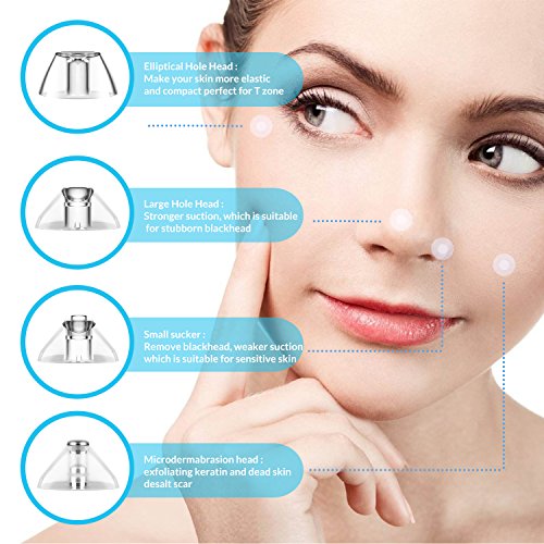 Blackhead Remover, Apolol Blackhead Vacuum Suction Removal, Acne Extractor Tool Set, Skin Facial Pore Cleaner, Comedo Microdermabrasion Exfoliating Machine for Women & Men    - Thumbnail 2