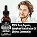Jamaican Black Castor Oil for Hair Growth. Strengthens & Hydrates Thinning, Dry Hair for a Healthier-Looking Scalp. For Women & Men – Vegan & Unscented Serum