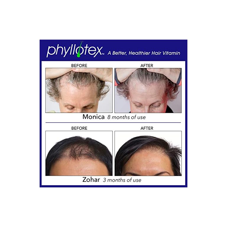 PHYLLOTEX4 Vitamins for Hair Growth for Women and Men, Scientifically