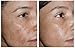 Melasma & pigment lightening serum 7-Day plus