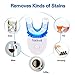Teeth Whitening Kit Dental Teeth Whitener Removes Stains Effectively, Non Sensitive Safe for Enamel, Led Light with 5 Bulbs, 3×3ml Gel Syringes