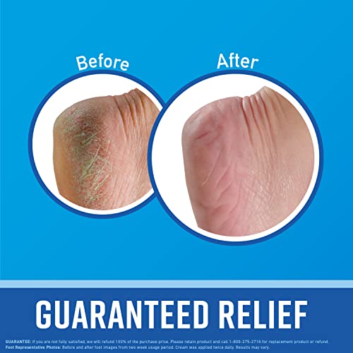 O’KEEFFE’S FOR HEALTHY FEET FOOT CREAM; GUARANTEED RELIEF FOR EXTREMELY DRY; CRACKED FEET; INSTANTLY BOOSTS MOISTURE LEVELS; 6.4 OUNCE JAR; VALUE SIZE; (PACK OF 1)