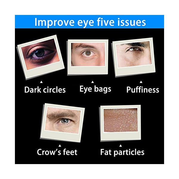 Hanyia-Men-day-and-night-eye-dark-circles-anti-puffiness-cream Hanyia Men day and night eye dark circles anti-puffiness cream