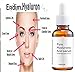 Endim Titanium Microneedle Derma Roller 540 Micro Needles Skin Care Needle 0.25mm+hyaluronic acid serum-EOE