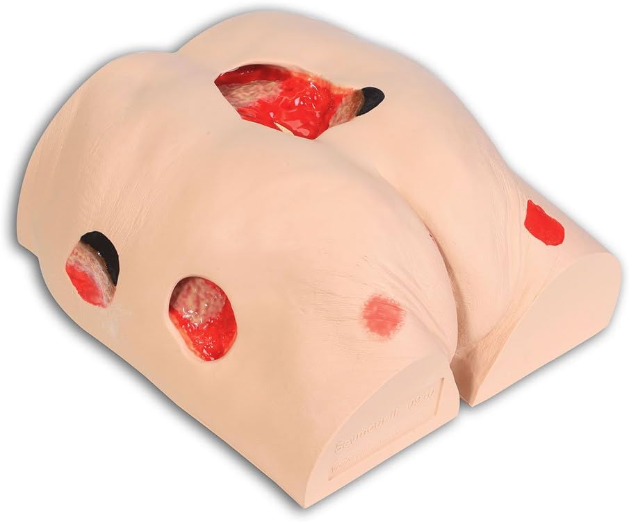 Best Vacuum Assisted Closure Device