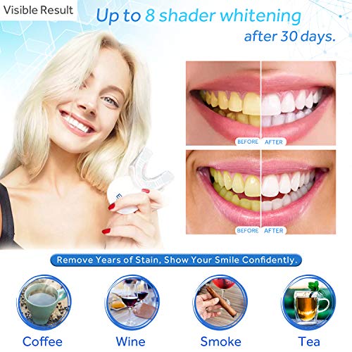 EZGO Teeth Whitening Kit with LED Light, 10 Minute Fast Result Teeth Whitening with 5ML