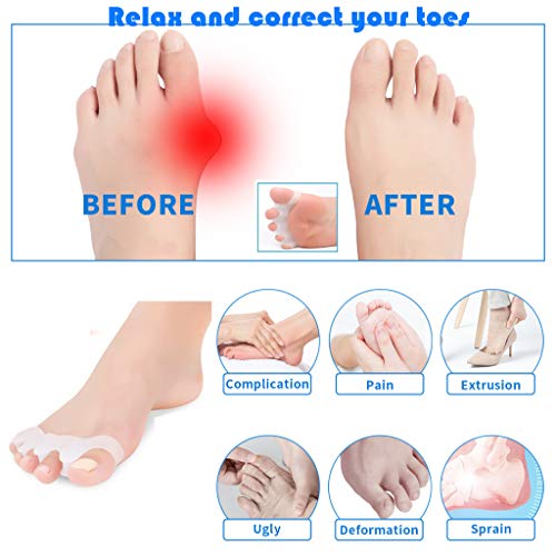 Bunion Corrector/Toe Separators Gel Hammer Toe Spacers for Men Women, BUVE Nail Pedicure Tools for Toe Relaxing Correct Streightener - Blue (2 pairs, white blue)