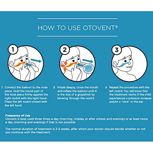 how ear fluid in relieve (5 All Balloons) It Balloon Otovent Import Extra how ear fluid in relieve (5 All Balloons) It Balloon Otovent Import Extra
