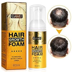 Minoxidil for Men 5% Minoxidil Foam for Hair growth
