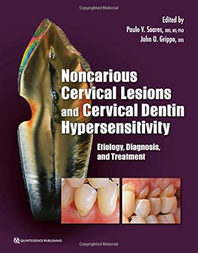 Download Noncarious Cervical Lesions and Cervical Dentin Hypersensitivity: Etiology, Diagnosis, and Treatment PDF