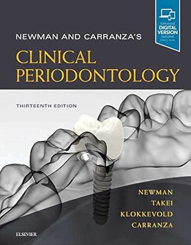 Download Newman and Carranza's Clinical Periodontology PDF