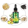 Ginger Germinal Oil, Hair Growth Oil, Hair Growth Serum, Ginger Germinal Essential Oil, Hair Loss Treatment Hair Care…