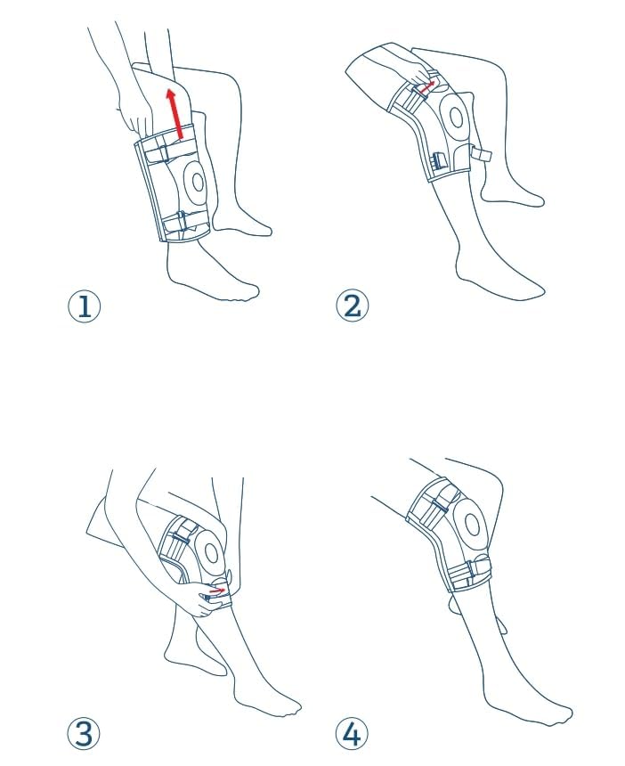 Rodillera profesional NEENCA para el dolor de rodilla, soporte ajustable con bisagras y estabilizadores laterales extraíbles, gran estabilidad para aliviar el dolor articular, artritis, desgarro de menisco, ligamento cruzado anterior (LCA), ligamento cruzado posterior (LCP), corredores y deportistas (HX043-MX, Small) (Negro, Medium)