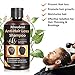 Anti-Hair Loss Shampoo, Hair Regrowth Shampoo, Natural Old Ginger Hair Care Shampoo Effective Solution for Hair Thinning & Breakage – Organic Hair Regrowth.Products for Men & Womenthumb 3
