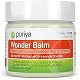 BEST Antifungal Balm, Natural formula for Athletes Foot, Ringworm, Jock Itch and Fungal Infections. Effectively Soothes Itchy, Scaly or Cracked Skin. Better Than OTC Treatment. Satisfaction Guarantee