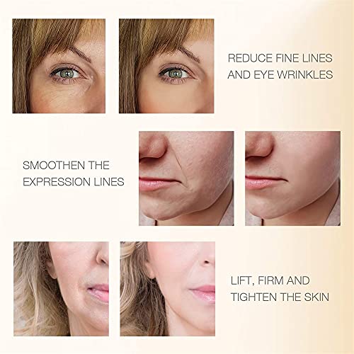 MLAY RF Radio Frequency Skin Tightening Machine for Facial and Body