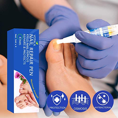Votala Nail Fungus Treatment, Powerful Toenail Fungus Treatment, Anti