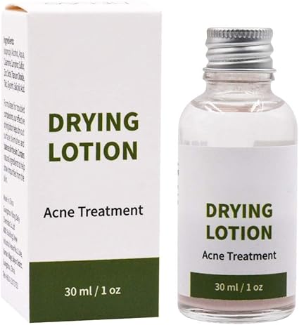 drying lotion for cystic acne