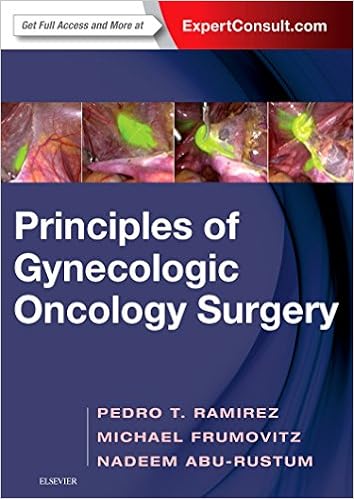 Principles Of Gynecologic Oncology Surgery 0000323428789 Medicine Health Science Books Amazon Com