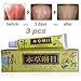 3pcs/Lot High Quality Chinese Herbal Eczema, Psoriasis Creams Dermatitis and Eczema Pruritus Psoriasis CEZUBEM Ointment