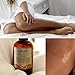 Psoriasis Body Serum | Soften Body Serum | Helps to soften the thickest psoriasis dry skin, scales and soothe dry, cracked or parched skin with vitamin rich emollients