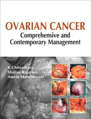 OVARIAN CANCER: COMPREHENSIVE AND CONTEMPORARY MANAGEMENT