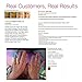 Hyaluronic Acid Serum for Face - 180 Cosmetics - Face Lift Skin Serum for Face and Eyes - Pure Hyaluronic Acid For Immediate Results - Hydrating - Anti Aging - Anti Wrinkle - Wrinkles and Fine Lines