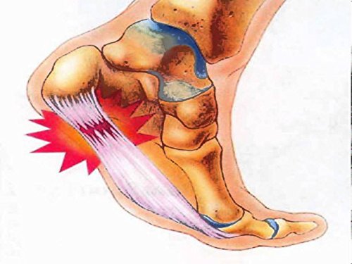 Plantar Fasciitis Shock Absorbing Heel Cushion - Protective Support Sleeve to Soothe and Moisturize Sore Feet and Relieve Pain from Plantar Fasciitis (1 Pair)