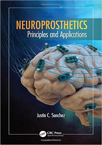 Neuroprosthetics Principles And Applications Rehabilitation Science In Practice Band 13 Amazon De Sanchez Justin C University Of Miami Coral Gables Florida Usa Bucher