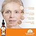 Vitamin C Serum, SALE Beauty Products for Anti Aging Skin Care - Contains Organic Vitamins C & E with Hyaluronic Acid Serum & Collagen - Get Rid of Age Spots & Dark Circles Under Eyes