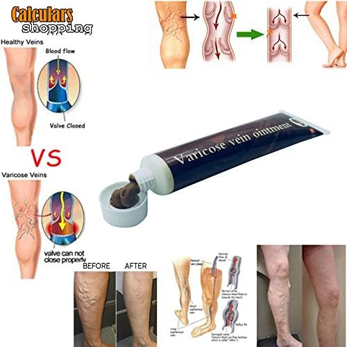 Veins Pain Vasculitis Phlebitis Treatment Varicose Veins Ointment Cream,vein defense healing cream,spider vein