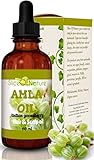 Slice Of Nature AMLA OIL for Hair - 100% Natural - Stops Premature Greying - Stops Alopecia - Promotes Hair Growth - No chemicals, Mineral oil or Synthetics - High concentrate amla berry extract 2 oz