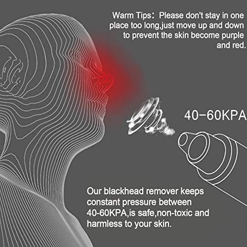 Blackhead Remover Blackhead Vacuum Suction Remover, USB Rechargeable Blackhead Comedo Vacuum Suction Facial Pore Cleanser Acne Extractor, Electric Skin Cleaner Blackhead Extraction Tool, (White)