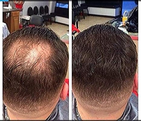 Amazon Com Hair Illusion Human Hair Fibers Not Synthetic Dark Brown Beauty