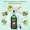 Hair-Growth-Serum-100ml-Hair-Growth-Treatment-Oil-Help-Hair-Follicle-Growth-Strengthen-Hair-Roots-Thickening-Regrowth-Hair-Loss-Treatment-for-Men-Women Hair Growth Serum, 100ml Hair Growth Treatment Oil, Help Hair Follicle Growth, Strengthen Hair Roots Thickening…