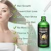 Hair-Growth-Serum-100ml-Hair-Growth-Treatment-Oil-Help-Hair-Follicle-Growth-Strengthen-Hair-Roots-Thickening-Regrowth-Hair-Loss-Treatment-for-Men-Women Hair Growth Serum, 100ml Hair Growth Treatment Oil, Help Hair Follicle Growth, Strengthen Hair Roots Thickening…