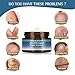 Foot Fungus Cream,Antifungal Foot Cream,Athletes Foot Cream,Foot Repair Cream Anti Itch Moisturizes for Athletes Foot Infections Foot Ringworm Cracked Feetthumb 3