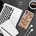 iPhone X Marble Case, ROITON Luxury Shiny White Gold Marble Design, [Support Wireless Charging] Clear Bumper TPU Soft Cover Case Apple iPhone X (Rose Gold)