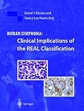 Human Lymphoma : Clinical Implications of the Real Classification, Mason, D. Y. and Harris, Nancy L., 1852331291