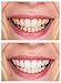 Mia Adora Teeth Whitening Activated Charcoal with Coconut - Natural Teeth Whitening at Home - Mint Flavor - Snow Effect