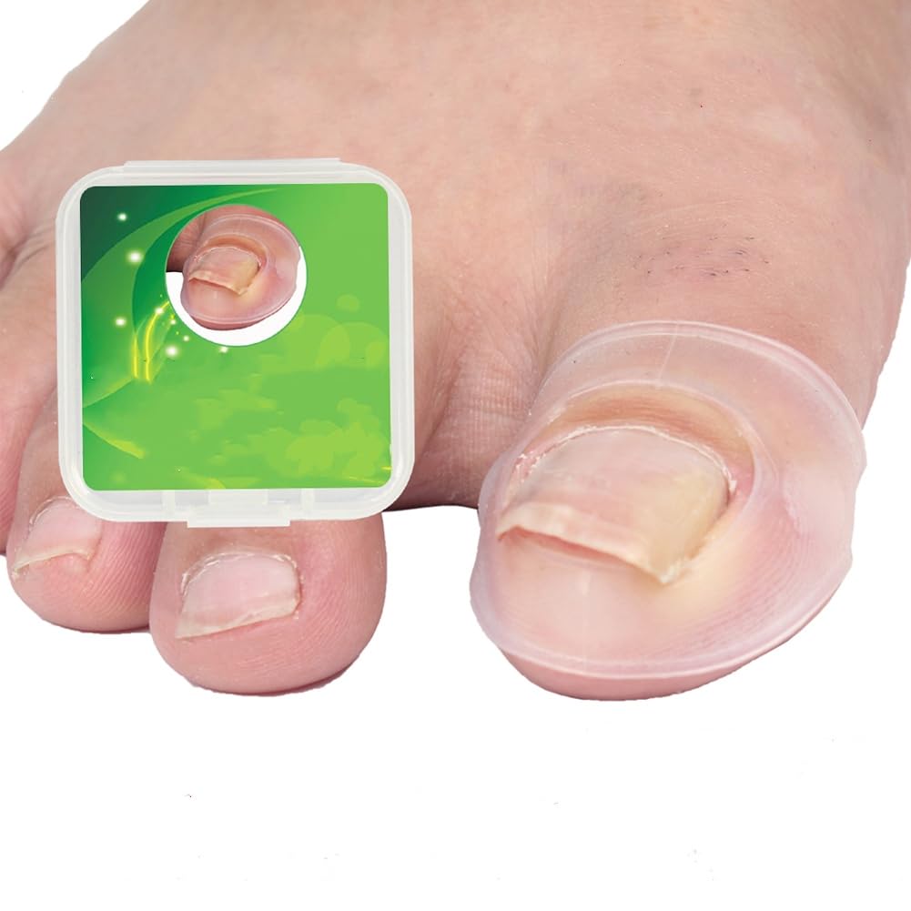 2pcs Ingrown Toenail Correction Silicone Toenail Corrector Pedicure Paronychia Correction Toenail Correction Patch