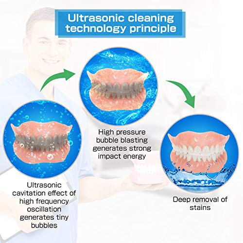 Ultrasonic Denture Cleaner, BlumWay Profession Retainer/Aligner/Mouth