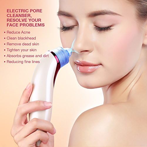 Electric Blackhead Remover, Acne Vacuum Suction Facial Pore Cleanser Cleaner MintBear Comedo Extraction Tool with 4 Microcrystalline Head and USB cable (Rose Red)