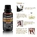 Hair Growth Serum, Hair Treatment, Hair Serum, Hair Loss Treatment, Natural Hair Growth - Anti Hair Loss Promotes Hair Growth, Solution for Hair Thinning and Loss, Hair Regrowth For Men Women